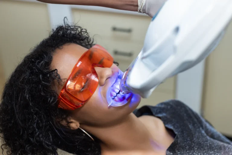 Teeth Whitening